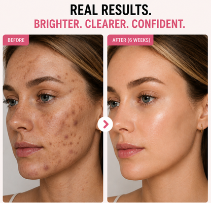 Dark Spot Correcting Glow Serum Kit™ | 4 in 1