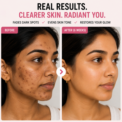 Dark Spot Correcting Glow Serum Kit™ | 4 in 1