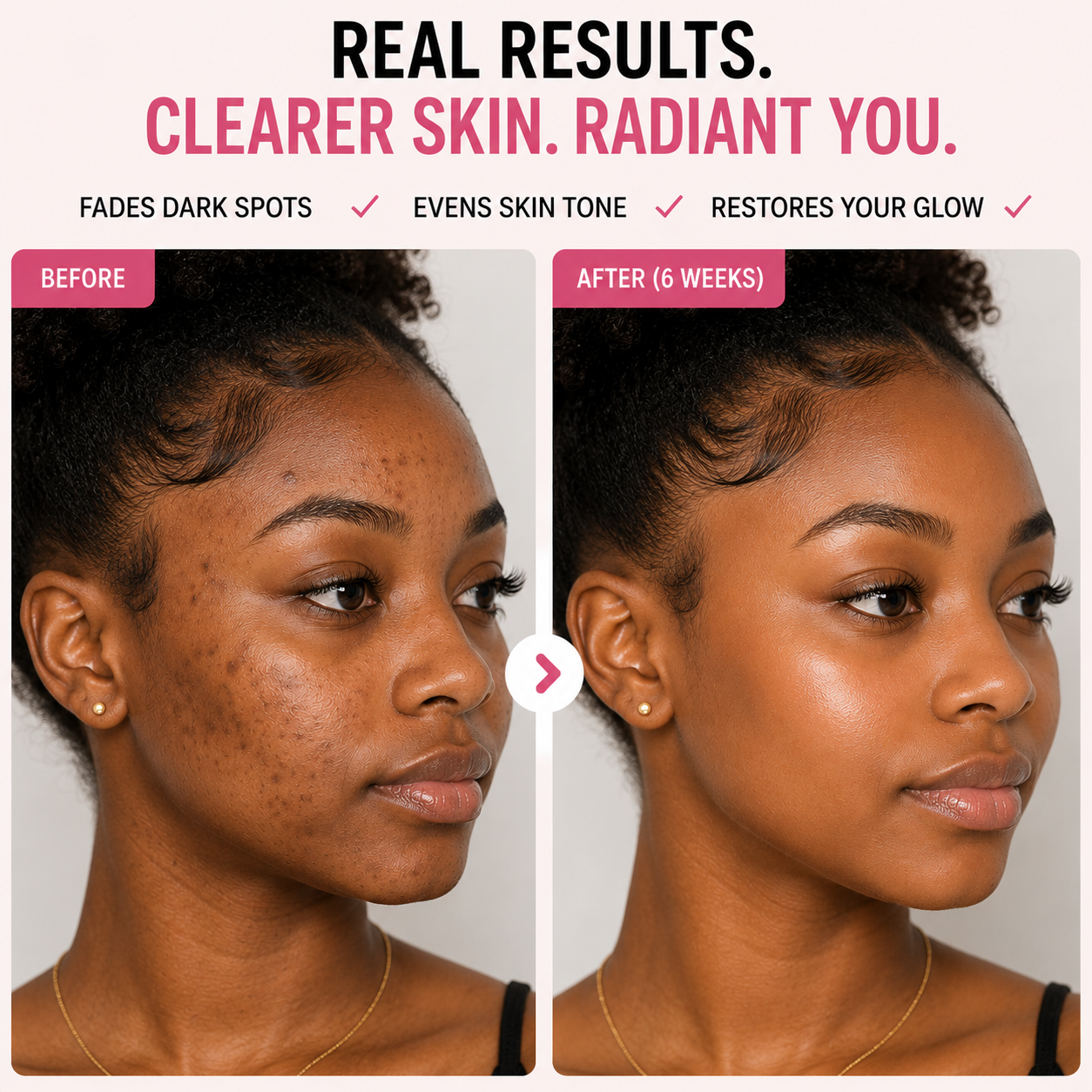 Dark Spot Correcting Glow Serum Kit™ | 4 in 1
