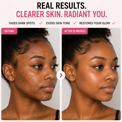 Dark Spot Correcting Glow Serum Kit™ | 4 in 1